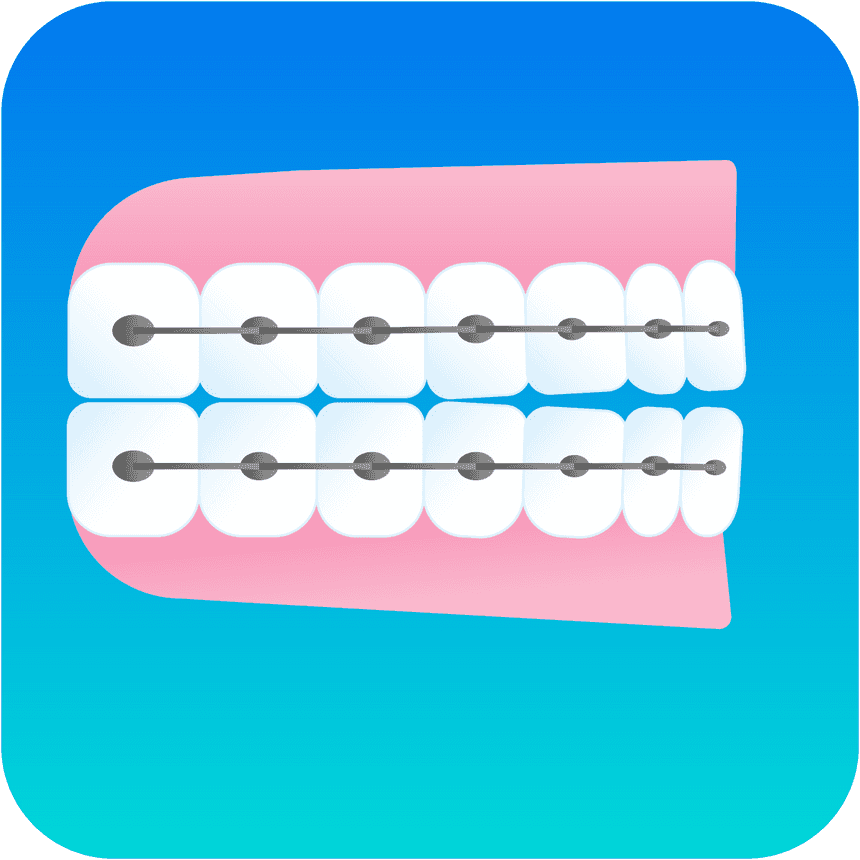 Illustration braces